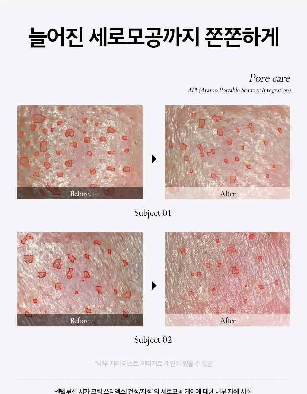 피부미 센텔루션 시카 크림 3X 100ml [지복합성] 상세페이지 25